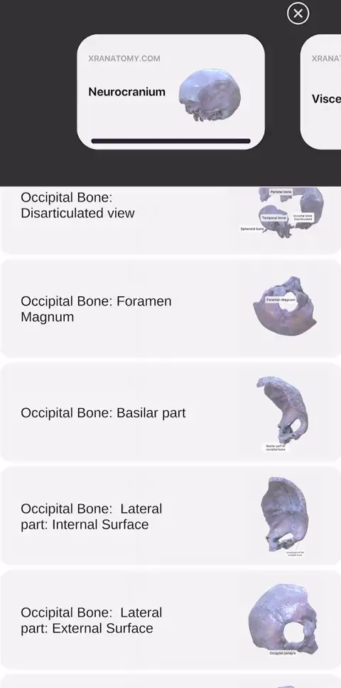 Contents menu with bone categories
