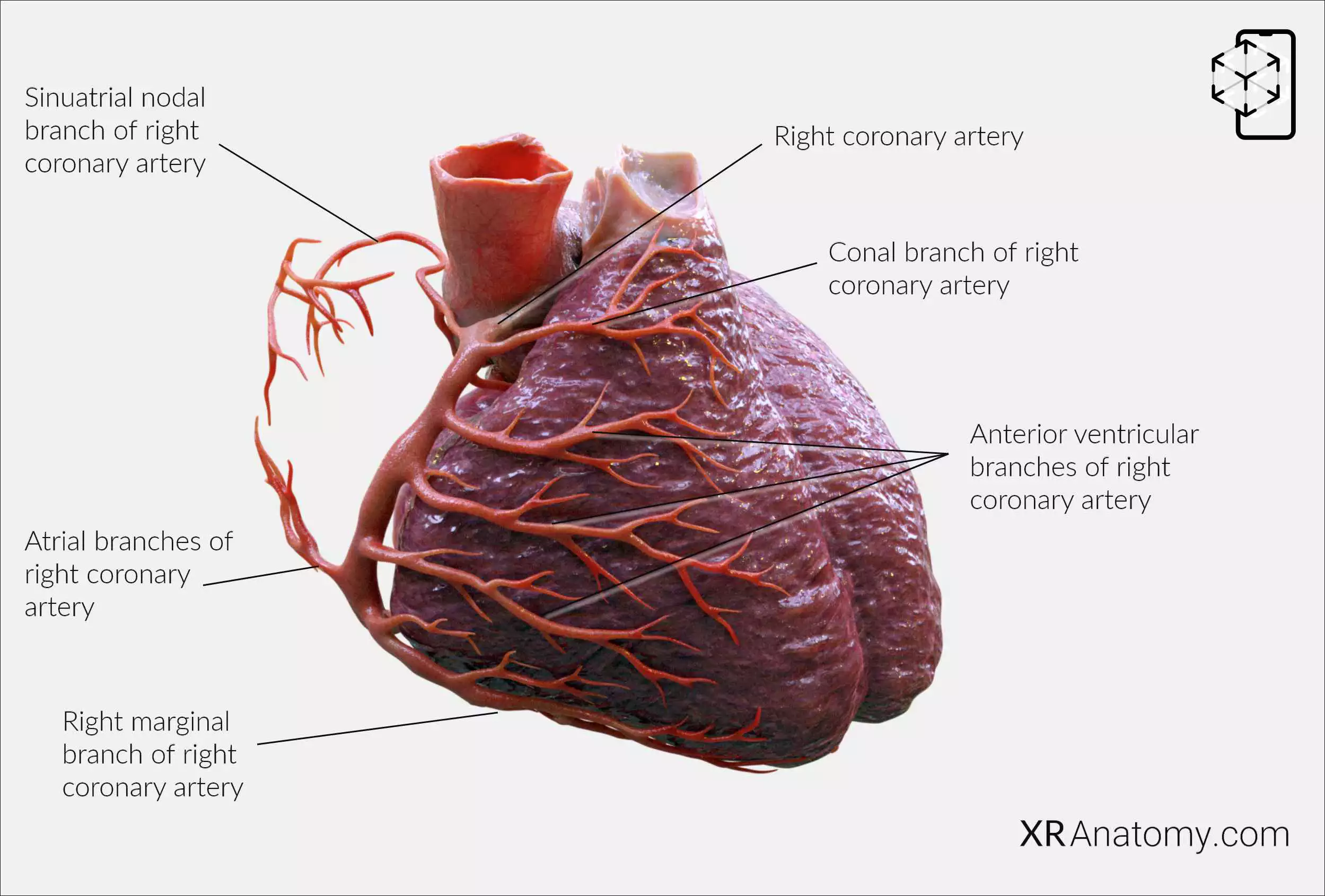 AR Figure 101 – Right coronary artery: Overview