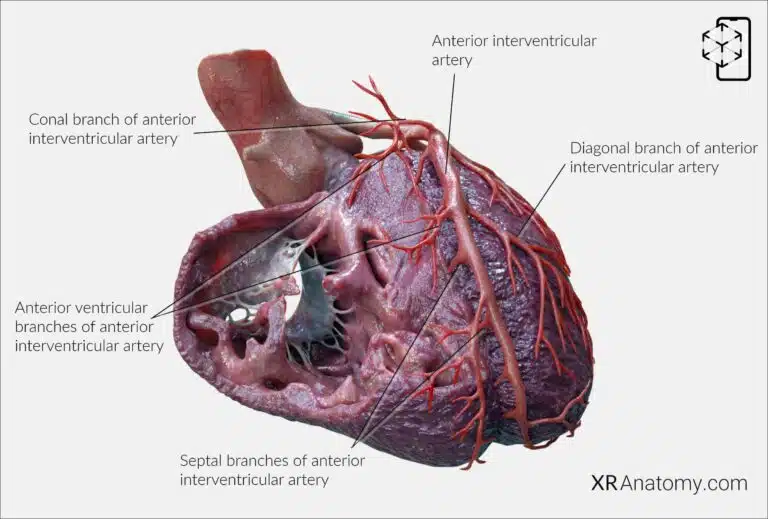 AR Figure 104 – Left Coronary Artery: Septal branches