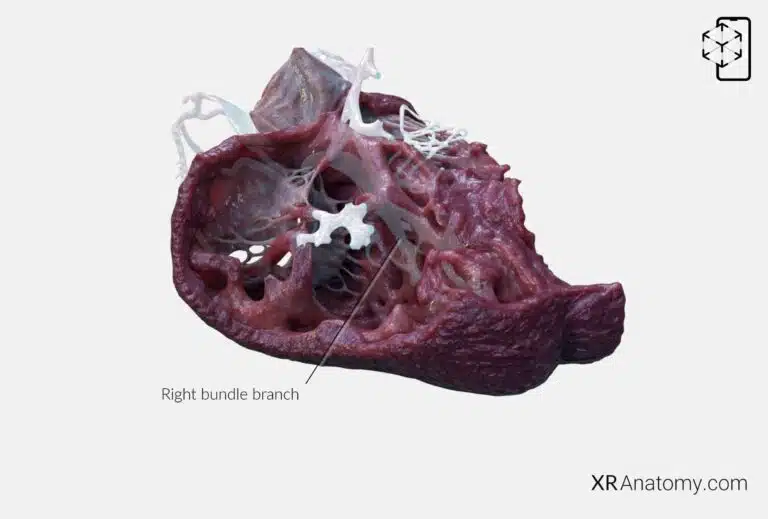 AR Figure 81 – Myocardium: Left bundle branch