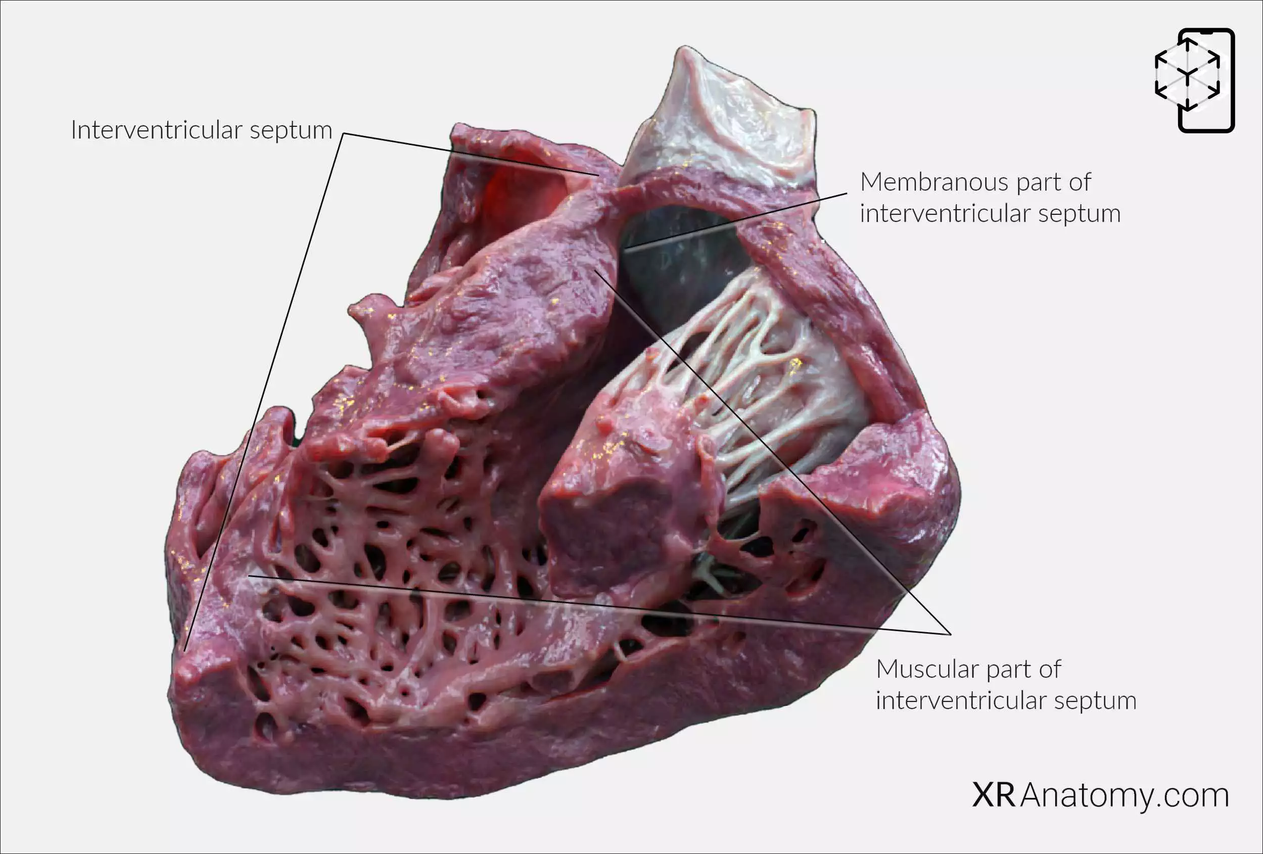 AR Figure 84 – Cardiac septa: Interventricular septum