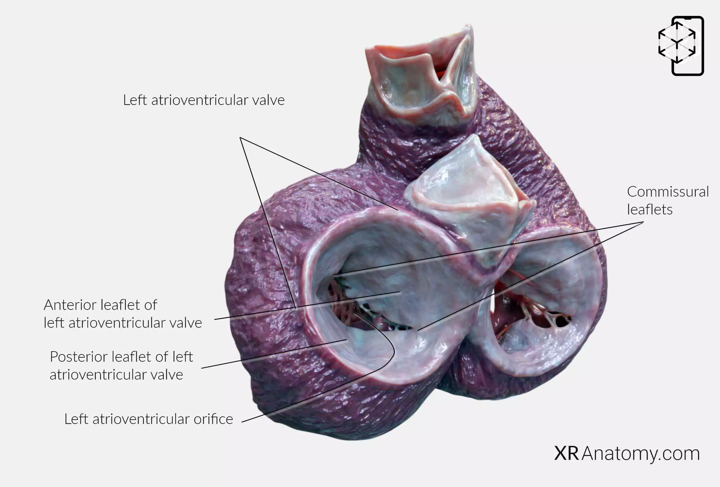 AR Figure 86 – Left atrioventricular valve