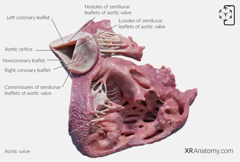 AR Figure 87 – Root of aorta: Aortic valve