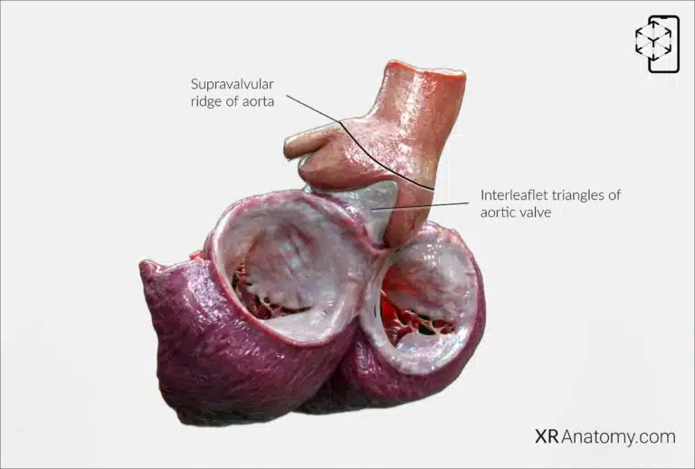 AR Figure 89 – Root of aorta: Aortic sinuses