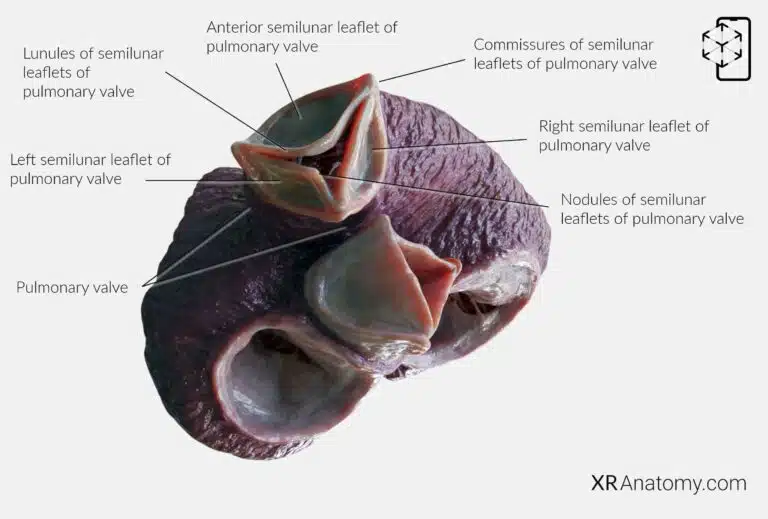 AR Figure 90 – Root of pulmonary trunk: Pulmonary valve