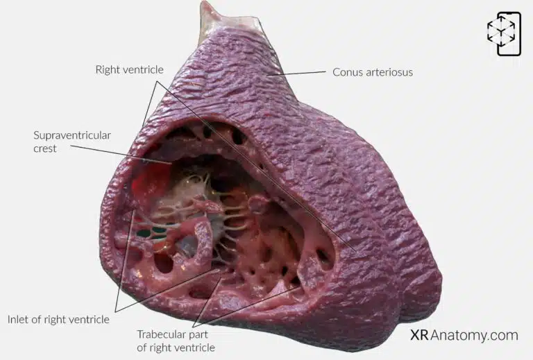 AR Figure 93 – Right ventricle: Overview