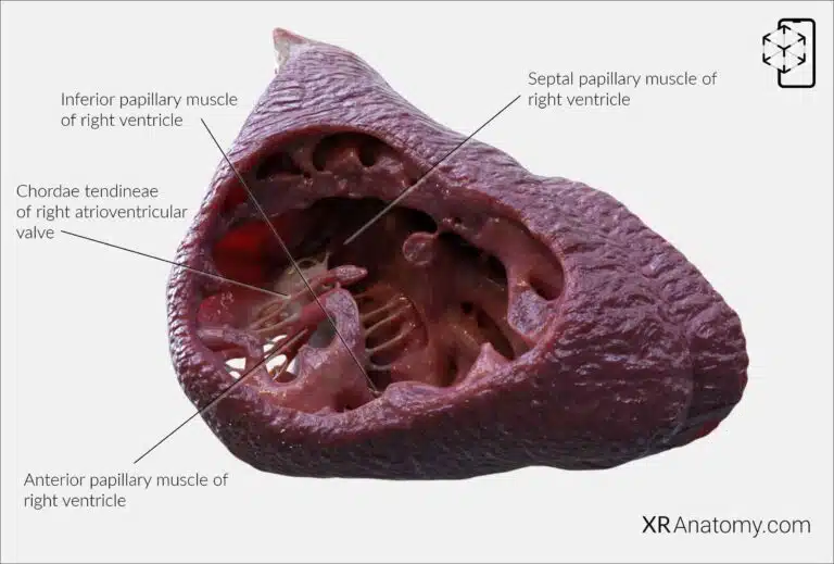 AR Figure 94 – Right ventricle: Trabecular part