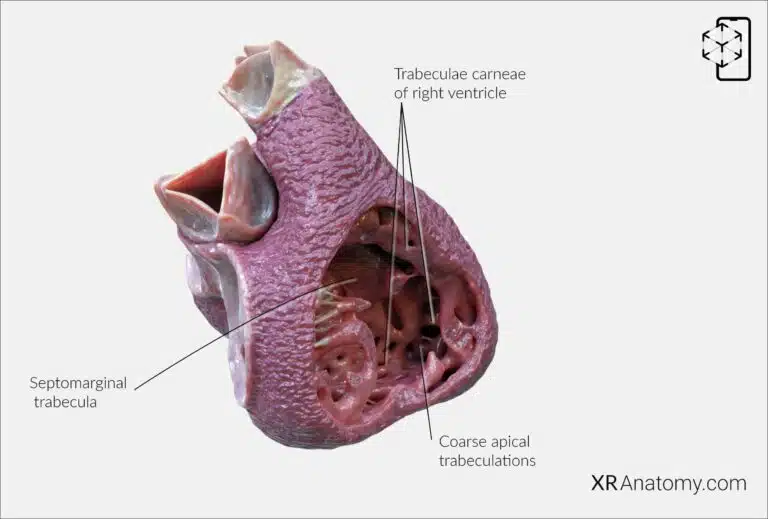 AR Figure 95 – Right ventricle: Papillary muscles