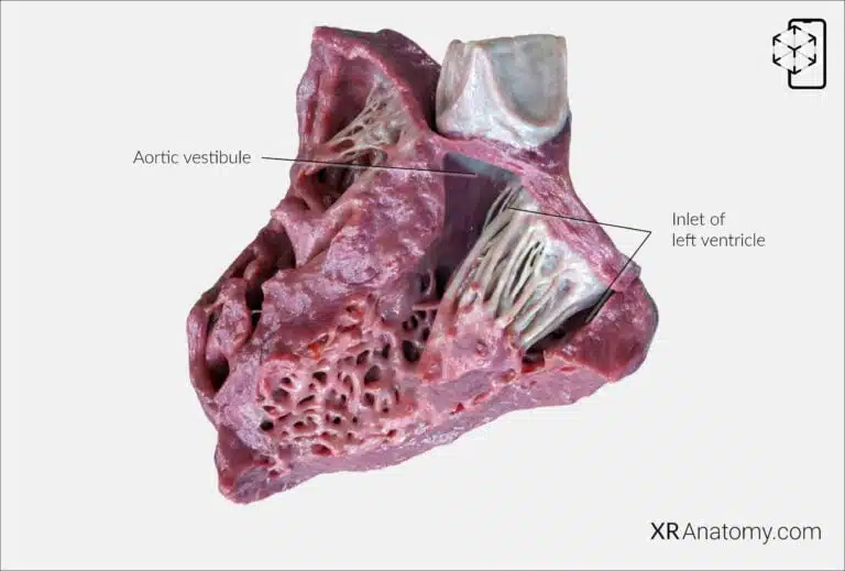 AR Figure 96 – Left ventricle: Overview