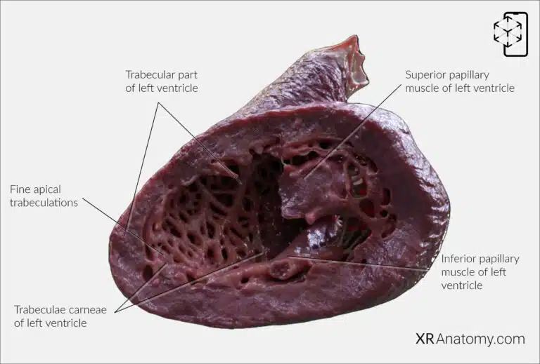 AR Figure 97 – Left ventricle: Trabecular part