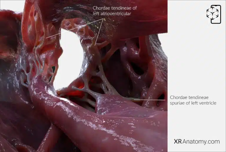 AR Figure 98 – Left ventricle: Chordae tendineae