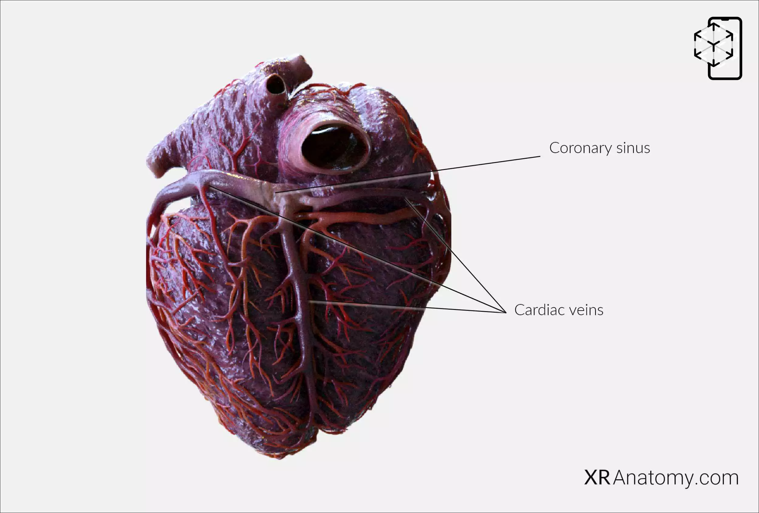 AR Figure 99 – Cardiac vessels: Inferior view