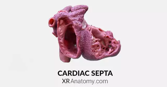 Cardiac Septum