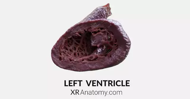 Left Ventricle AR