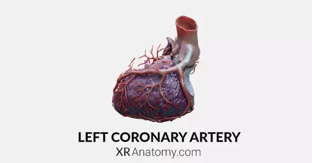 Left Coronary Artery AR