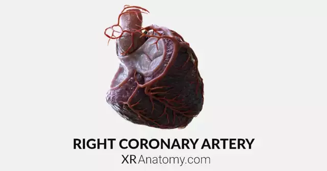 Right Coronary Artery AR