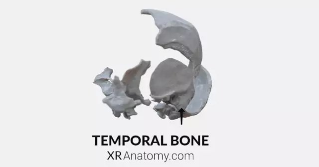 Temporal Bone