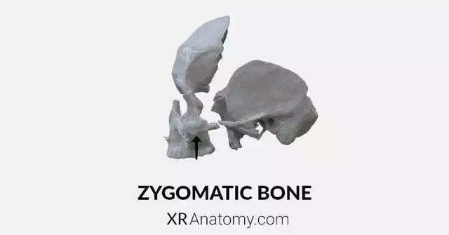 Zygomatic Bone