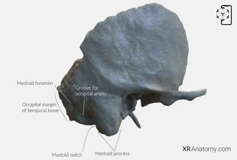 AR Figure 10 – Temporal Bone: Petrous part