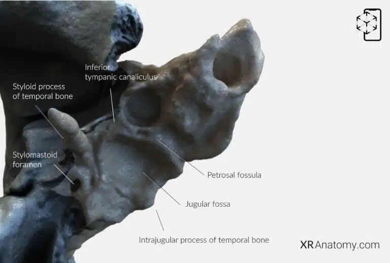 AR Figure 14 – Temporal Bone: Petrous part