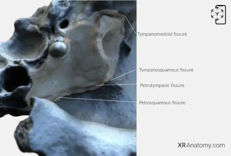 AR Figure 15 – Temporal Bone: Tympanic part