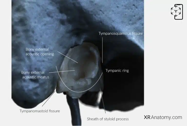 AR Figure 16 – Temporal Bone: Squamous part