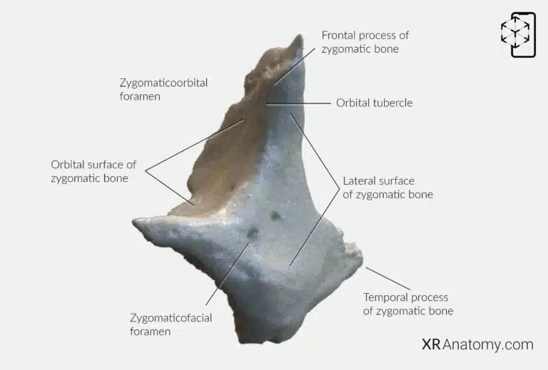 AR Figure 67 – Zygomatic bone: Anterior view