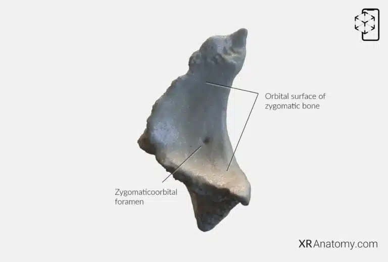 AR Figure 69 – Zygomatic bone: Orbital surface