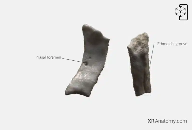 AR Figure 73 – Nasal bone