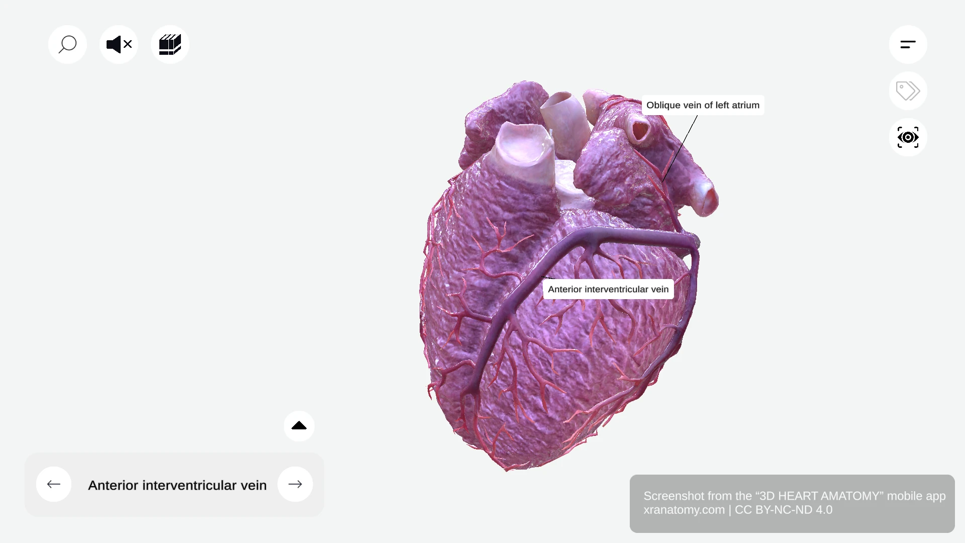 Anterior interventricular vein anatomy traveling in anterior interventricular groove with left anterior descending artery
