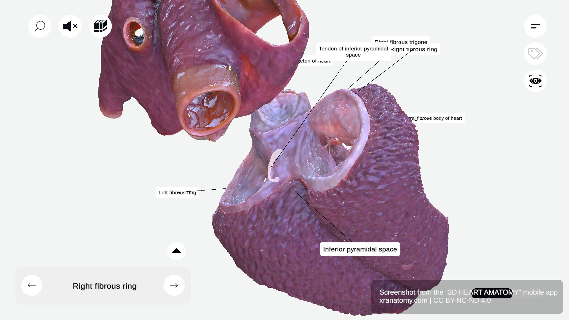 Inferior pyramidal space of the heart showing convergence of grooves and surrounding coronary vessels