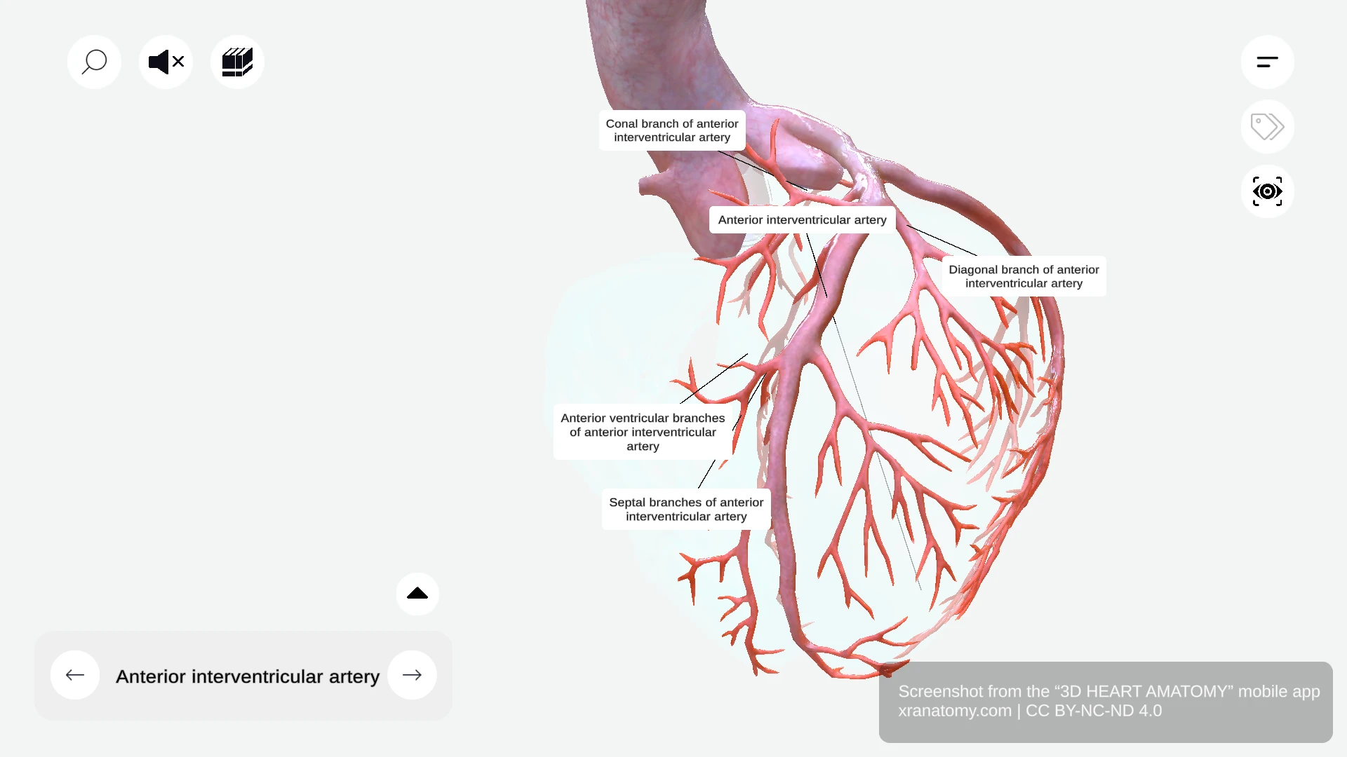 Branches of anterior interventricular artery showing conal branch, anterior ventricular branches, diagonal branch, and septal branches