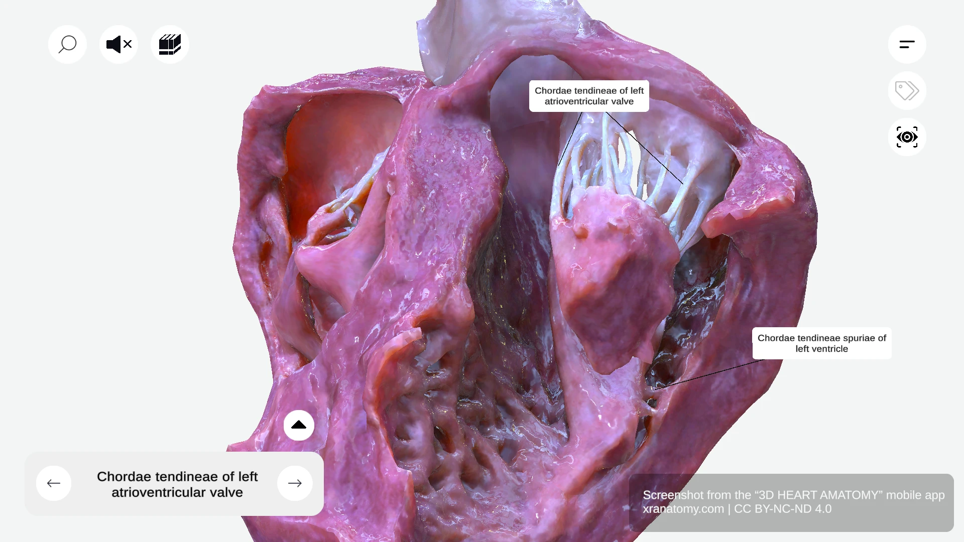 Chordae tendineae of left ventricle showing fibrous cords connecting papillary muscles to mitral valve leaflets