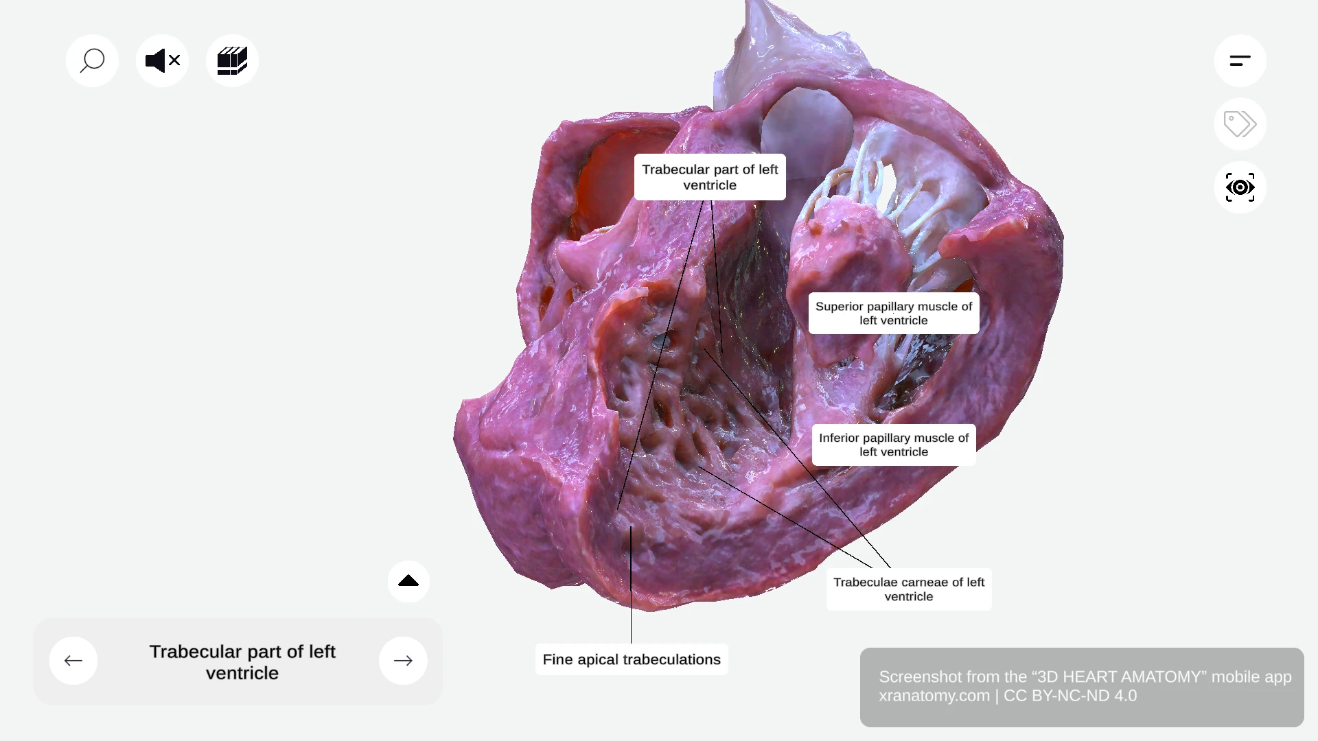 Papillary muscles of left ventricle showing superior and inferior papillary muscles