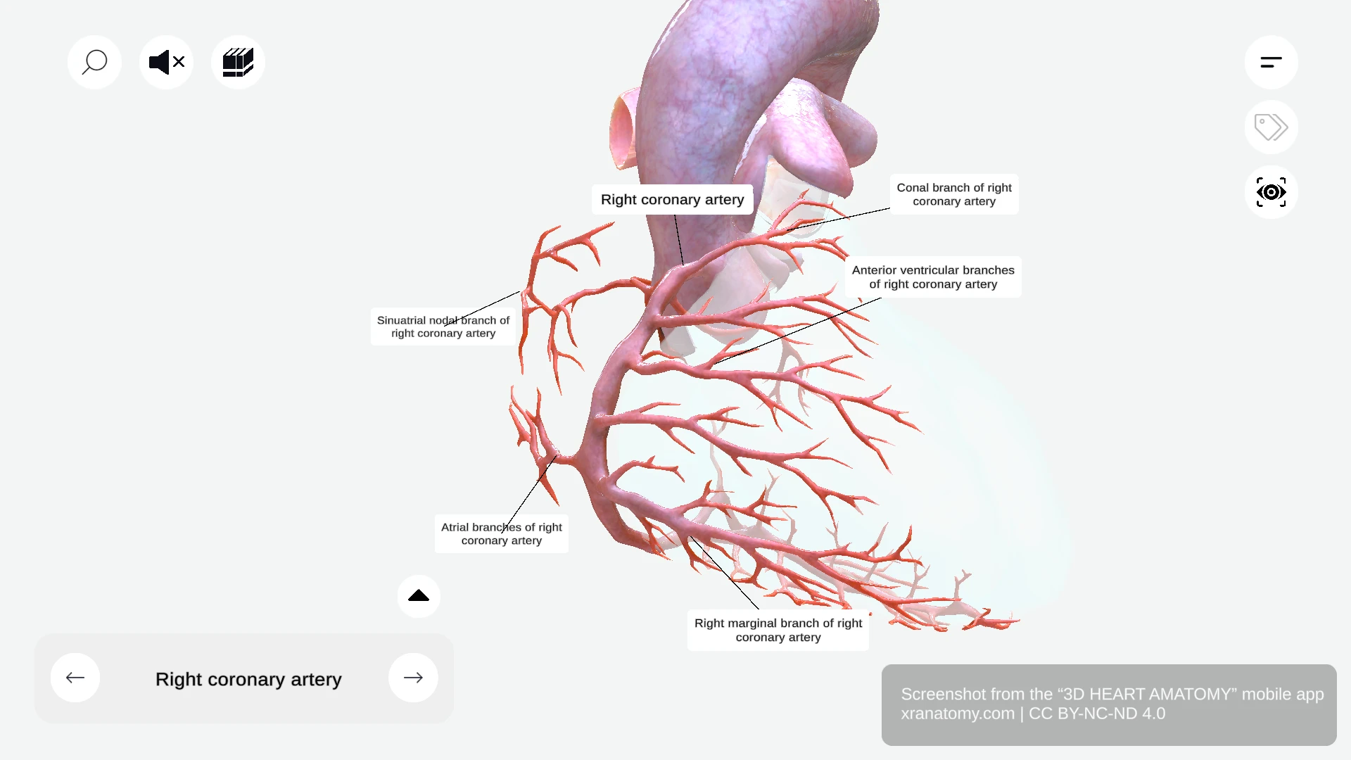 Branches of right coronary artery showing conal branch, SA nodal branch, atrial branches, anterior ventricular branches, and right marginal branch
