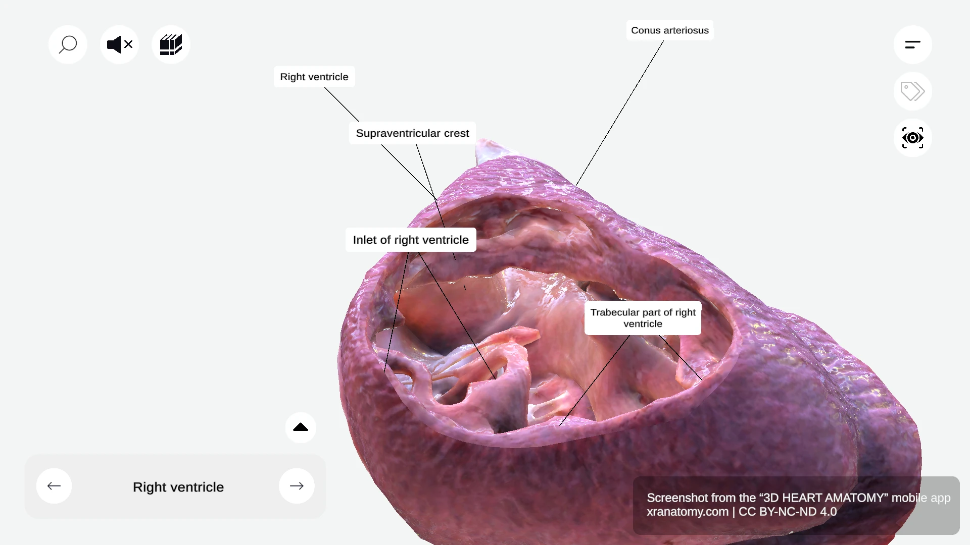 Outlet of right ventricle showing conus arteriosus (infundibulum) and pulmonary valve