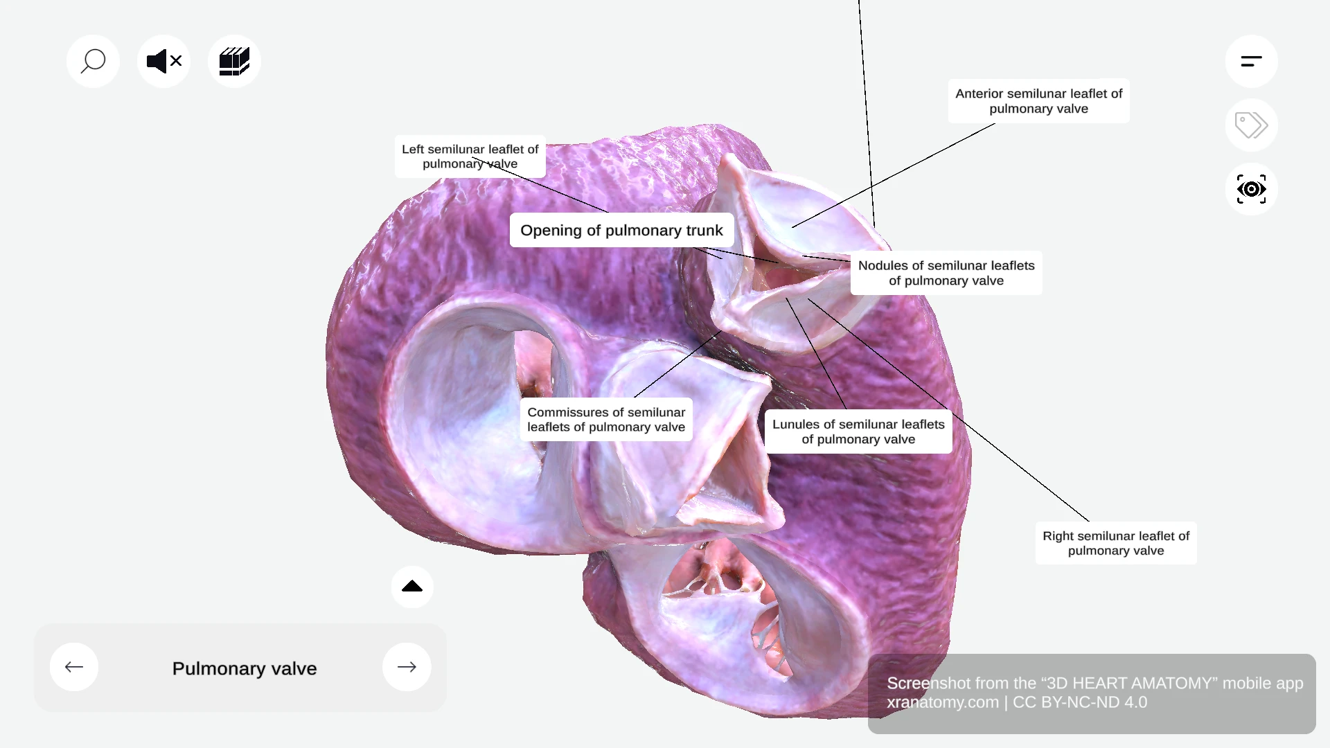 Opening of pulmonary trunk showing passage for blood ejection from right ventricle guarded by pulmonary valve