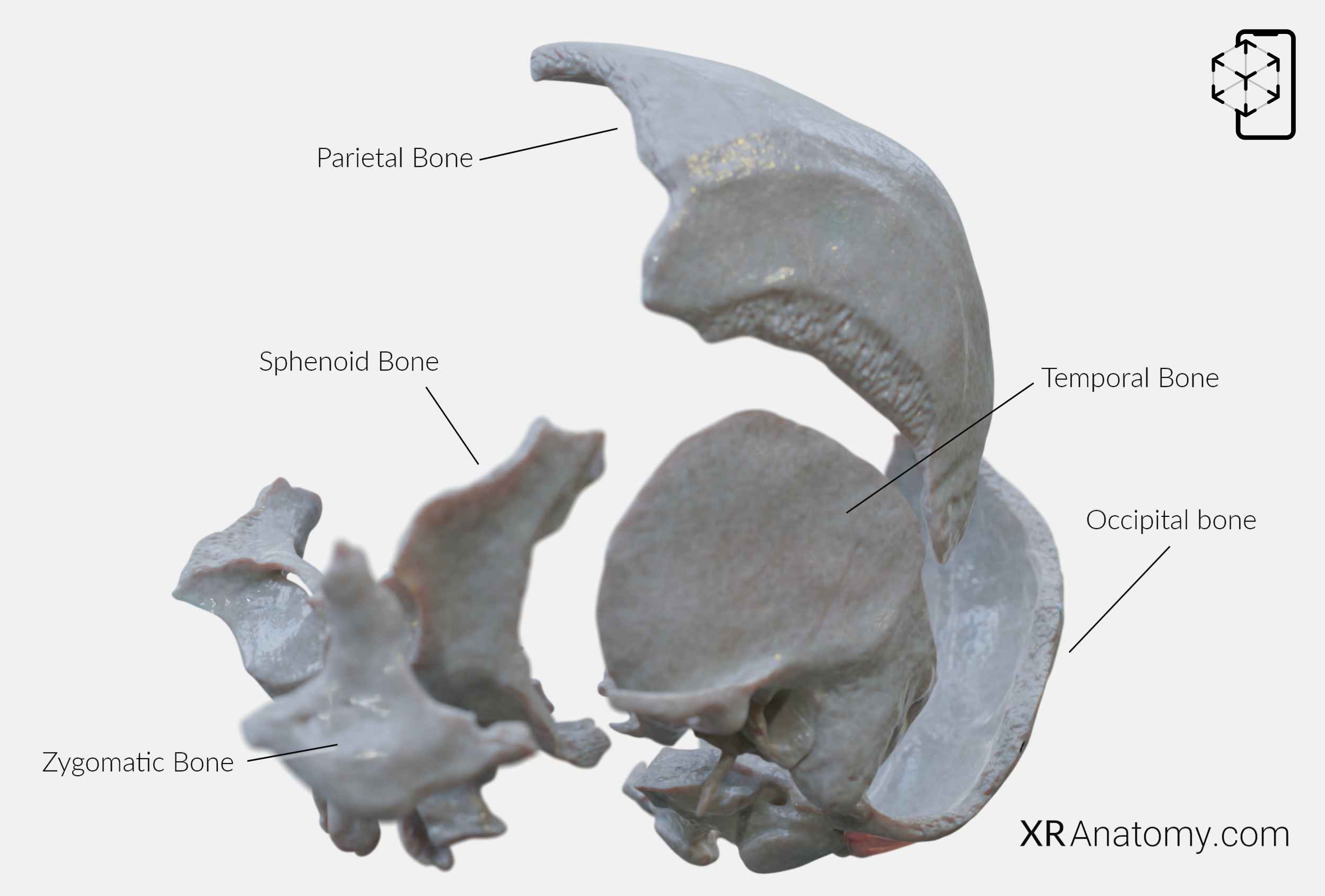 Temporal Bone In Ar For Free 2698