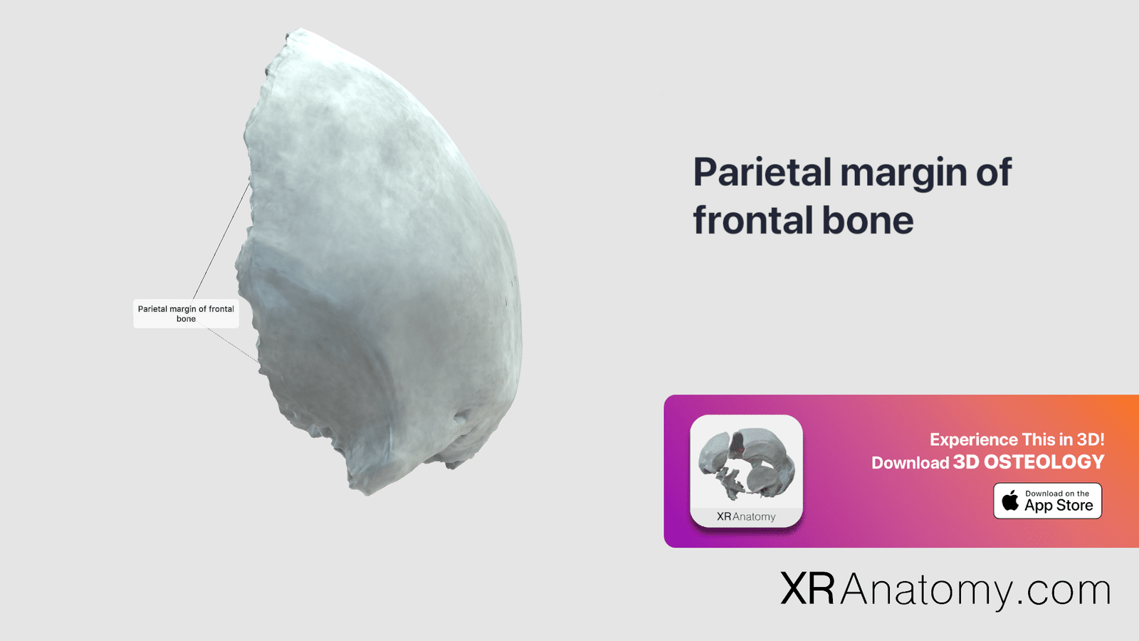 Parietal Margin Of Frontal Bone Xr Anatomy 2388