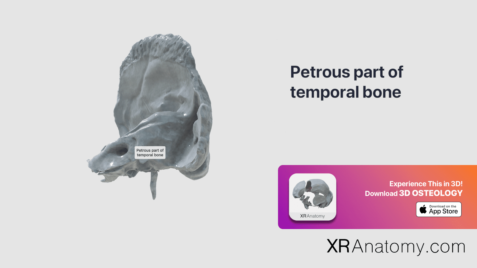 Petrous Part Of Temporal Bone - XR Anatomy
