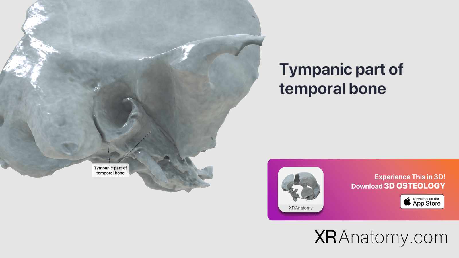 Tympanic Part Of Temporal Bone Xr Anatomy 4905